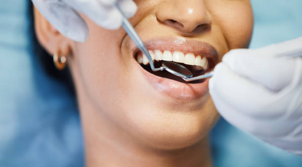 Best Emergency Treatment for Oral Infections in University Center, VA